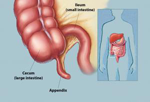 Appendix Surgery in Pune