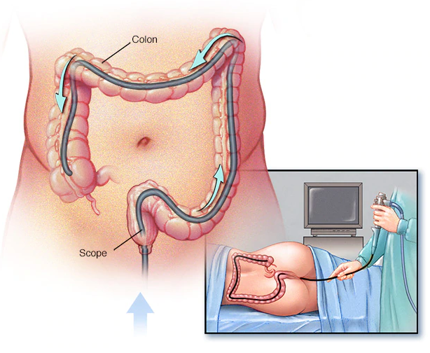 Laparoscopic Surgery in Pune