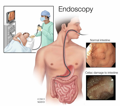 Laparoscopic Surgery in Pune