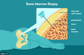 Biopsy Surgery Hospital in Pune