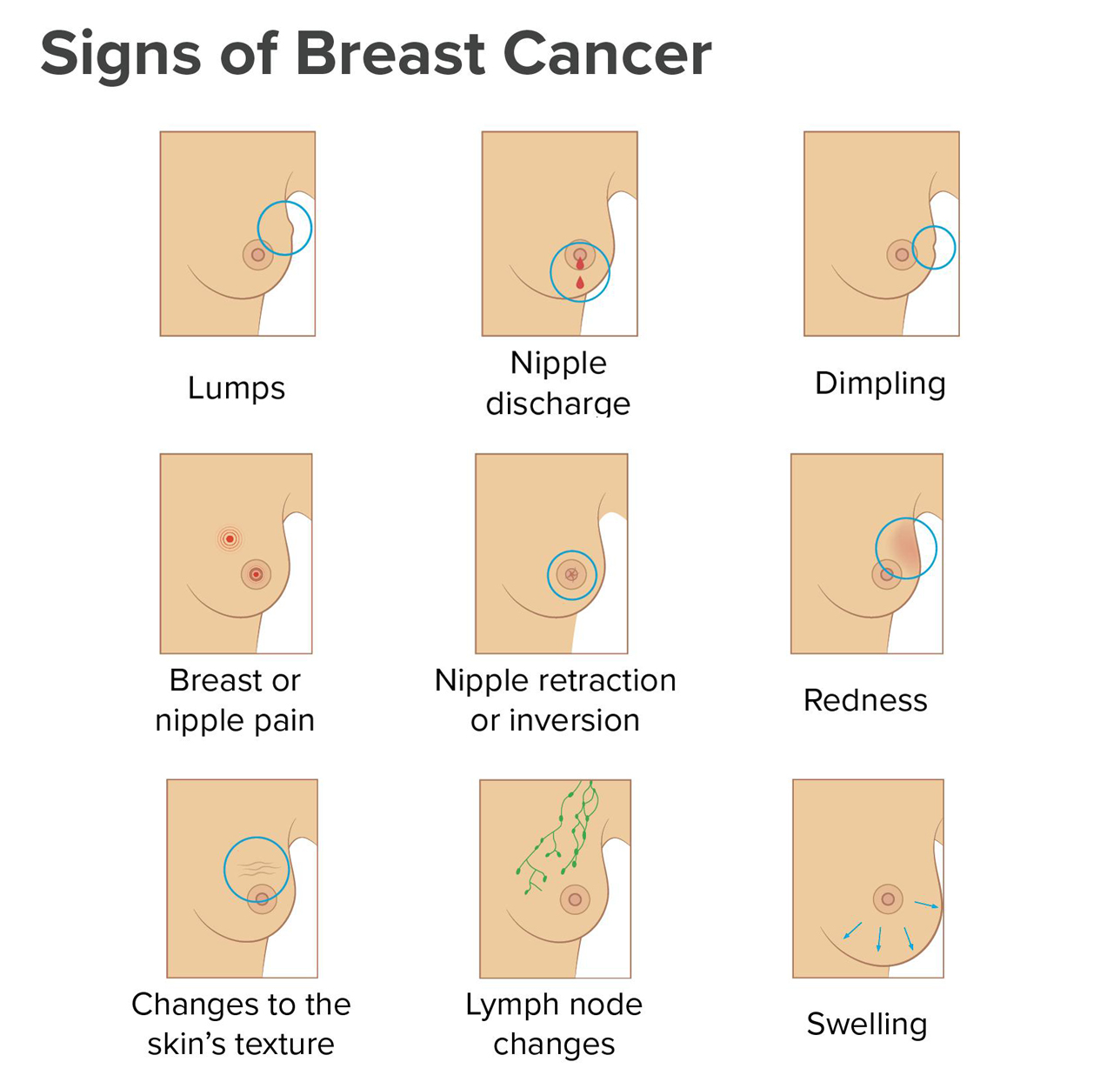 Breast Surgery Hospital in Pune