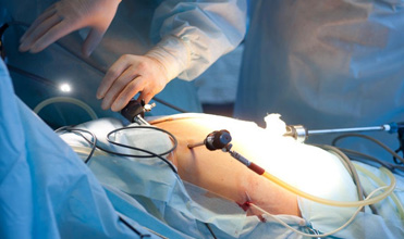 laser piles surgery in pune