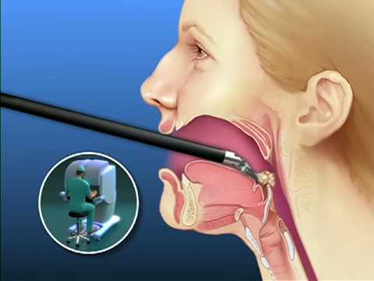 Best Tongue Cancer Surgery Hospital in Pune